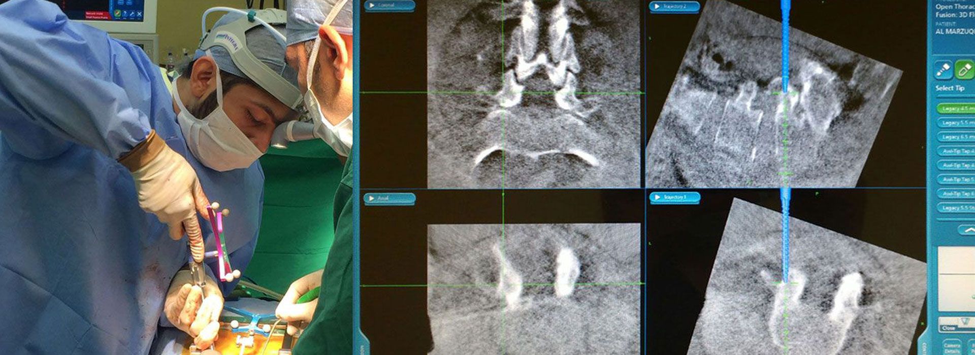 computer assisted spine surgery
